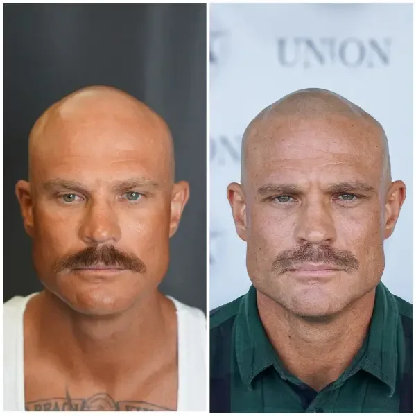 SMP before and after