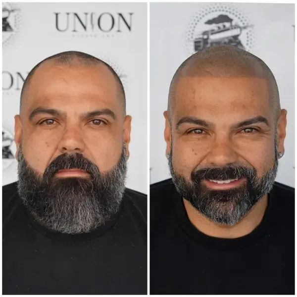 Density enhancement before and after
