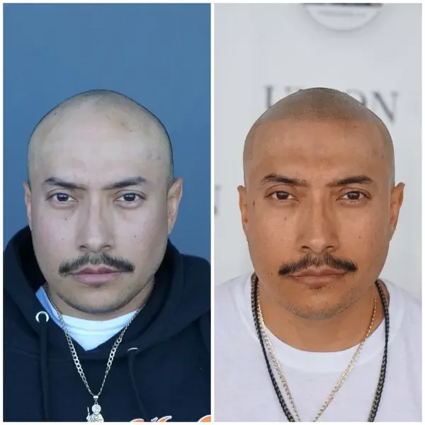 SMP before and after